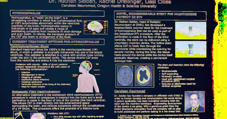 This Brain Implant Could Treat Depression—It Just Got Cleared For Human Trials